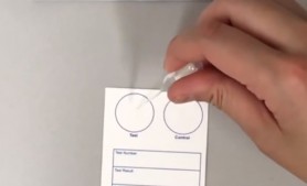 Testul care poate detecta persoanele vaccinate: Pui o picătură de apă pe card